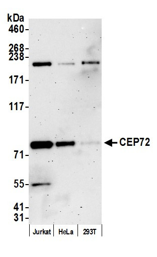 CEP72 Antibody in Western Blot (WB)