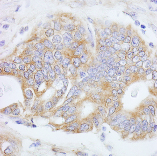 PTPN12 Antibody in Immunohistochemistry (Paraffin) (IHC (P))
