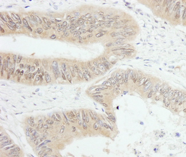 PTPN12 Antibody in Immunohistochemistry (Paraffin) (IHC (P))