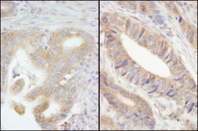 PTPN12 Antibody in Immunohistochemistry (Paraffin) (IHC (P))