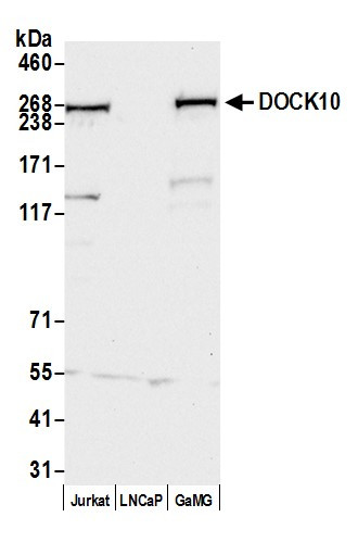 DOCK10 Antibody in Western Blot (WB)