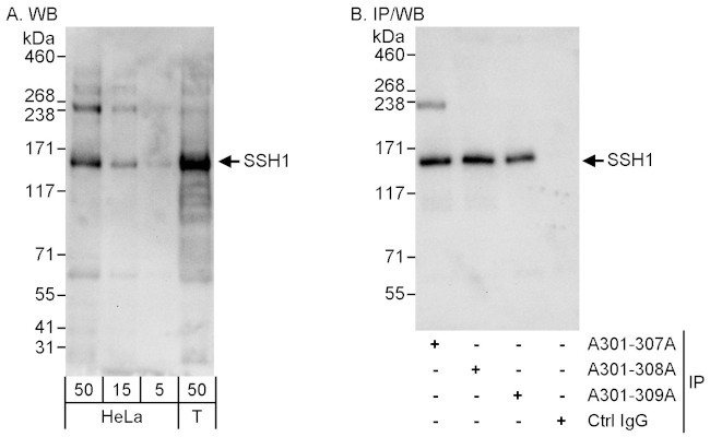 SSH1 Antibody in Western Blot (WB)