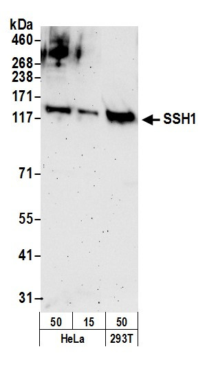 SSH1 Antibody in Western Blot (WB)