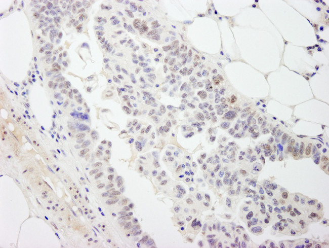 DDX54 Antibody in Immunohistochemistry (Paraffin) (IHC (P))