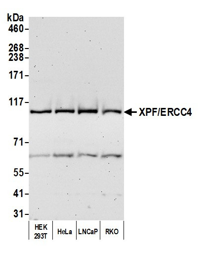 XPF/ERCC4 Antibody in Western Blot (WB)