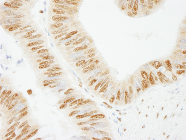 PSF/SFPQ Antibody in Immunohistochemistry (Paraffin) (IHC (P))