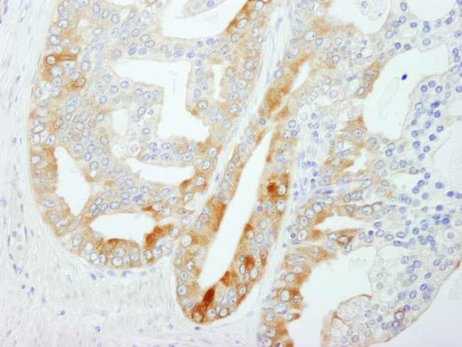 FASN Antibody in Immunohistochemistry (Paraffin) (IHC (P))