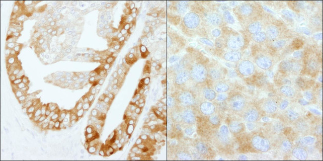 FASN Antibody in Immunohistochemistry (Paraffin) (IHC (P))