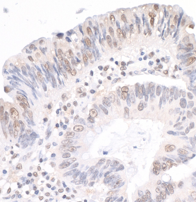 MYBBP1A Antibody in Immunohistochemistry (Paraffin) (IHC (P))