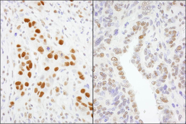 GTF2I/TFII-I Antibody in Immunohistochemistry (Paraffin) (IHC (P))