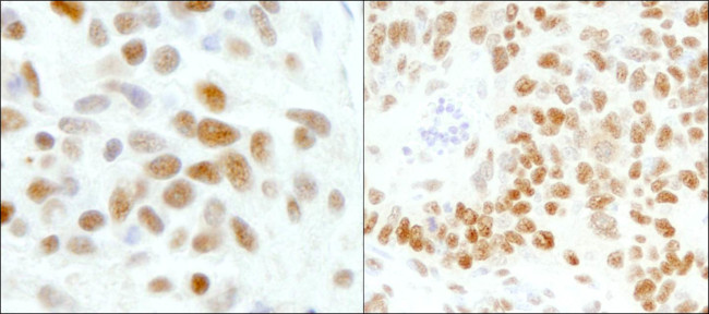 GTF2I/TFII-I Antibody in Immunohistochemistry (Paraffin) (IHC (P))