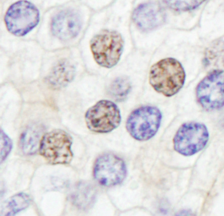 GTF2IRD/TFII-IRD1 Antibody in Immunohistochemistry (Paraffin) (IHC (P))