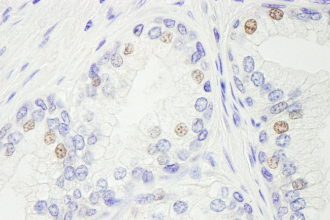 GTF2IRD/TFII-IRD1 Antibody in Immunohistochemistry (Paraffin) (IHC (P))