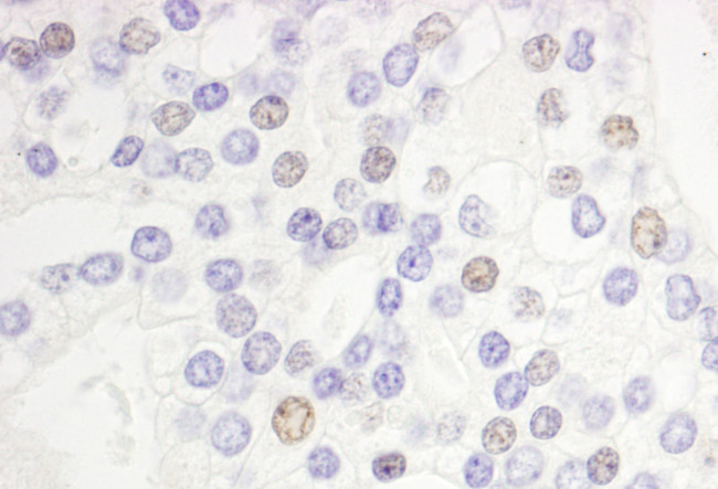 DEK Antibody in Immunohistochemistry (Paraffin) (IHC (P))