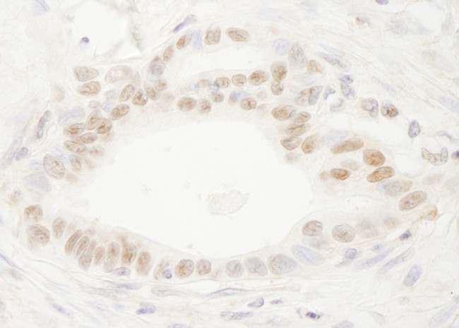 DEK Antibody in Immunohistochemistry (Paraffin) (IHC (P))