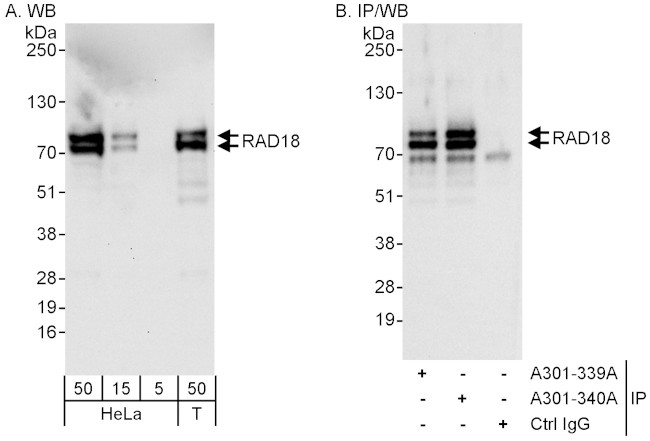 Rad18 Antibody in Western Blot (WB)