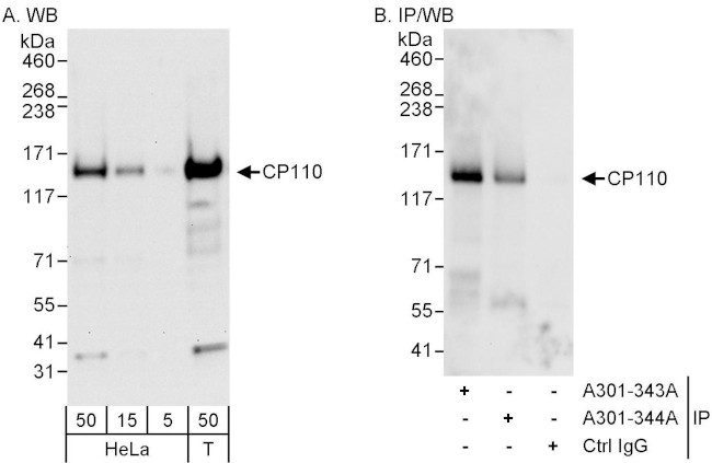 CP110 Antibody in Western Blot (WB)