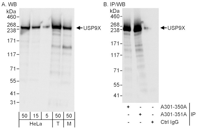 USP9X Antibody in Western Blot (WB)