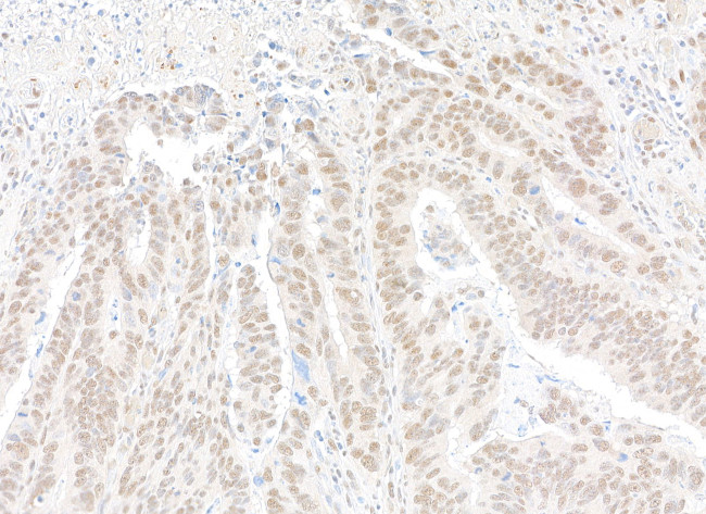 CPSF68 Antibody in Immunohistochemistry (Paraffin) (IHC (P))
