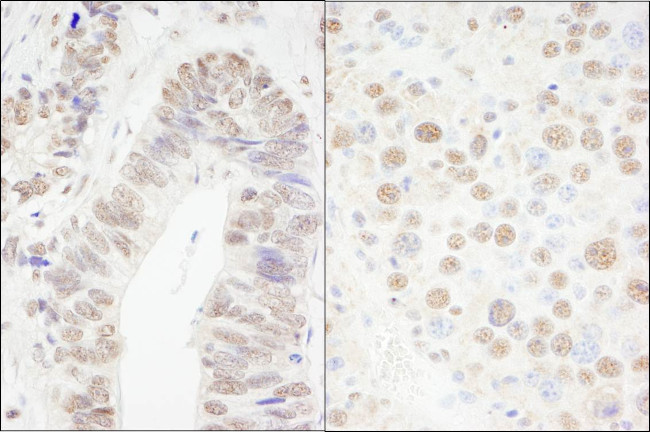 CPSF68 Antibody in Immunohistochemistry (Paraffin) (IHC (P))