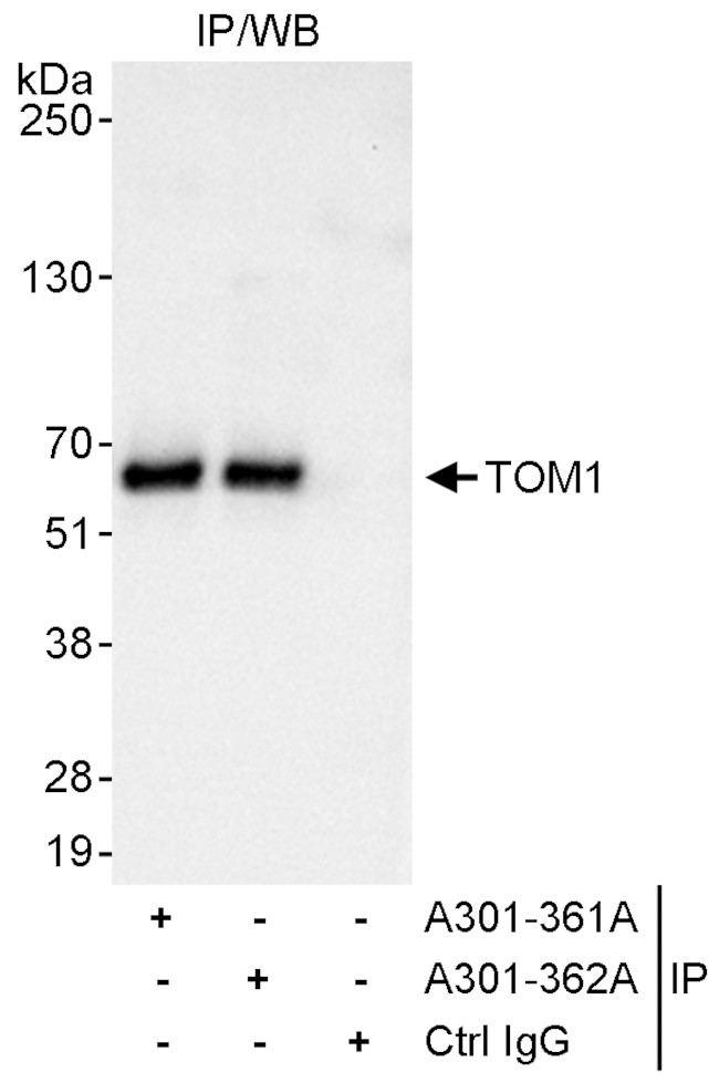 TOM1 Antibody in Immunoprecipitation (IP)