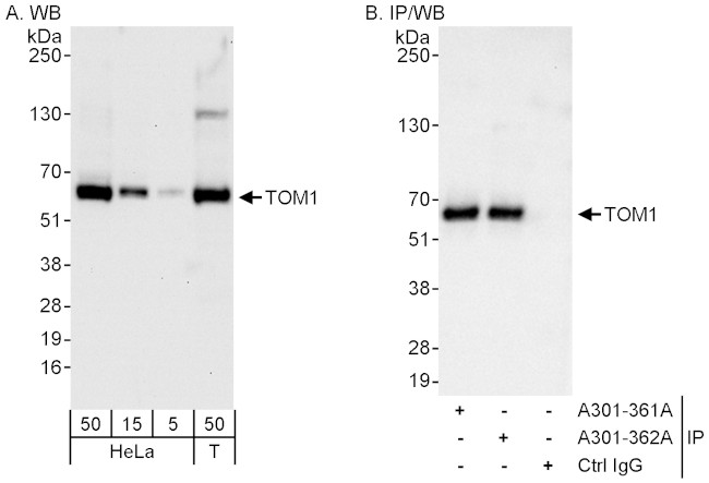 TOM1 Antibody in Western Blot (WB)