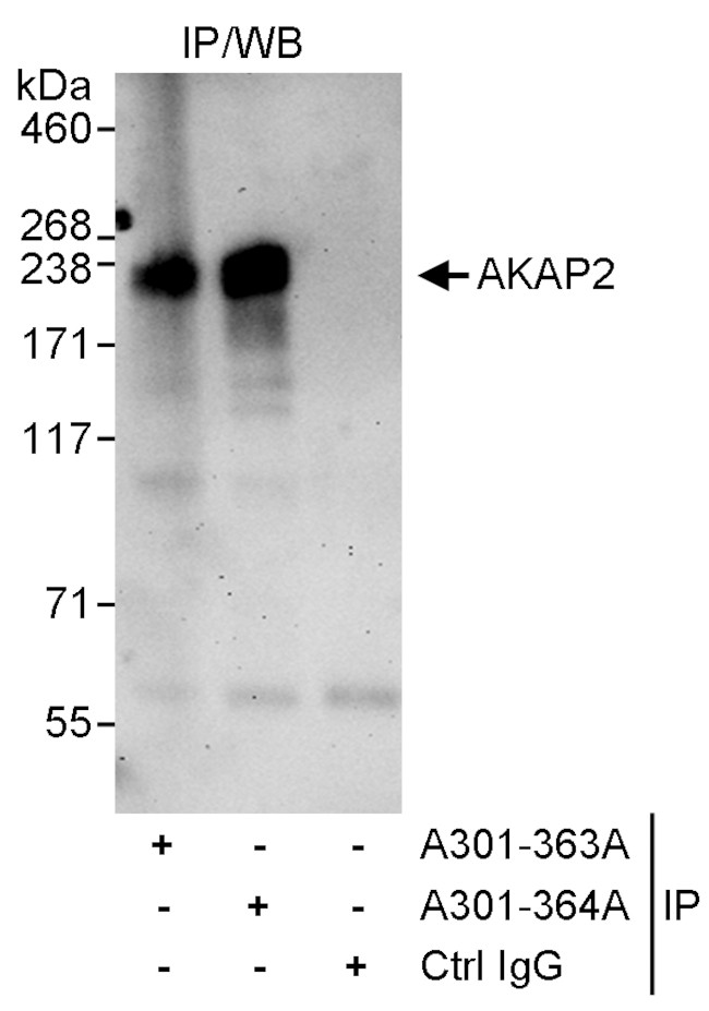 AKAP2 Antibody in Immunoprecipitation (IP)