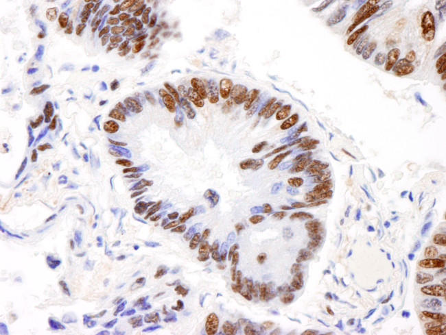AKAP8L/HA95 Antibody in Immunohistochemistry (Paraffin) (IHC (P))