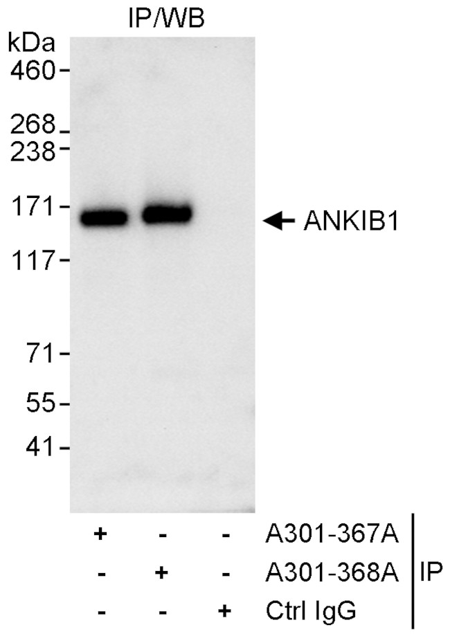 ANKIB1 Antibody in Immunoprecipitation (IP)