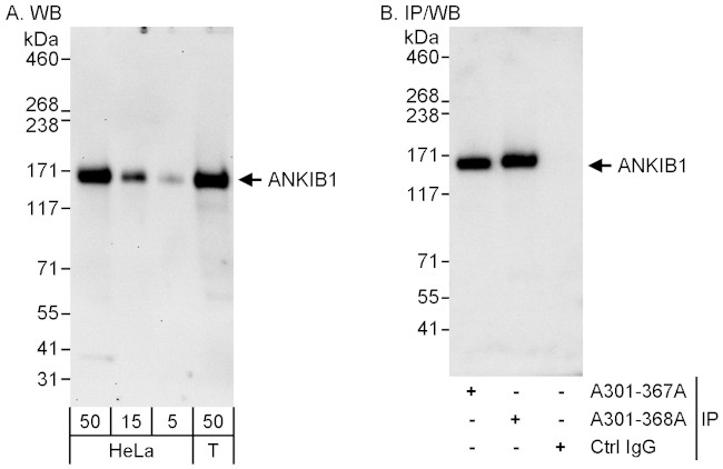 ANKIB1 Antibody in Western Blot (WB)