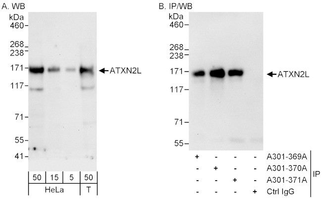 ATXN2L Antibody in Western Blot (WB)