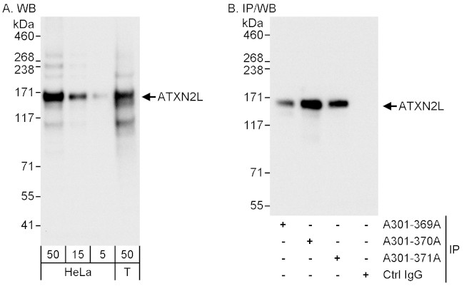 ATXN2L Antibody in Western Blot (WB)