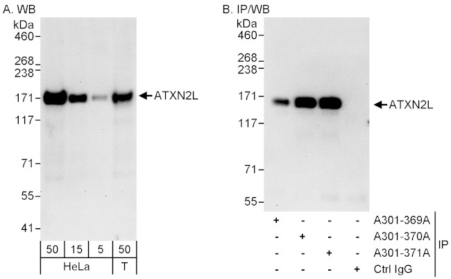 ATXN2L Antibody in Western Blot (WB)