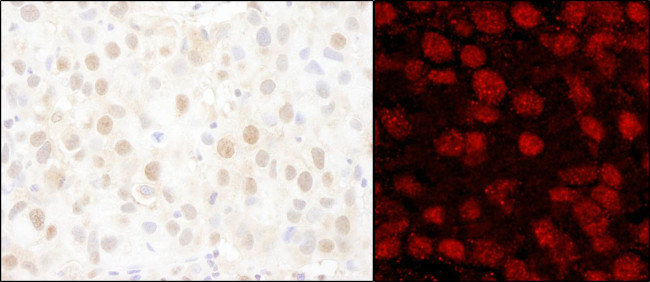 PARP1 Antibody in Immunohistochemistry (Paraffin) (IHC (P))