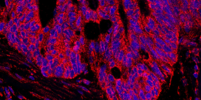 AKAP1 Antibody in Immunohistochemistry (Paraffin) (IHC (P))