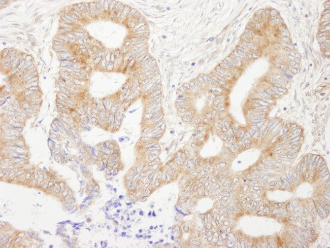 AKAP1 Antibody in Immunohistochemistry (Paraffin) (IHC (P))