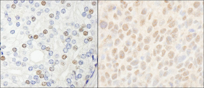 HDAC7 Antibody in Immunohistochemistry (Paraffin) (IHC (P))