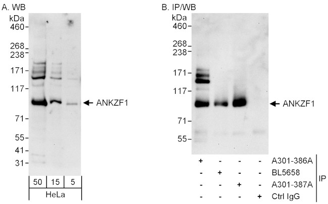 ANKZF1 Antibody in Western Blot (WB)