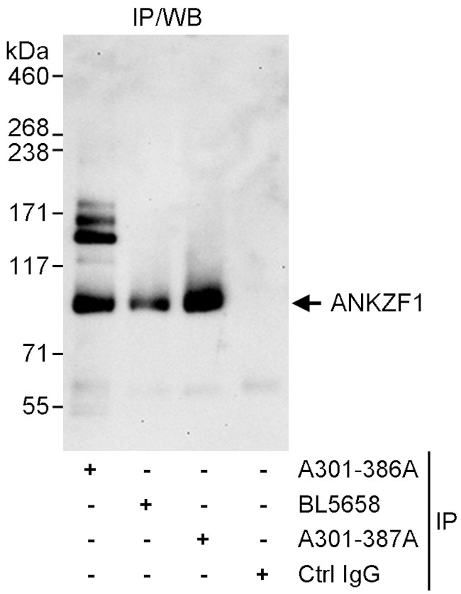 ANKZF1 Antibody in Immunoprecipitation (IP)