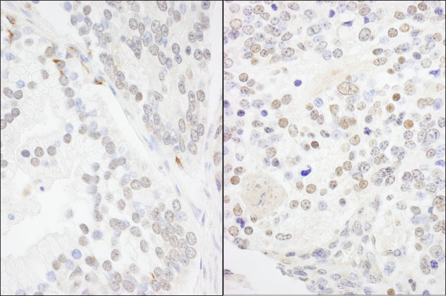 ANKS3 Antibody in Immunohistochemistry (Paraffin) (IHC (P))
