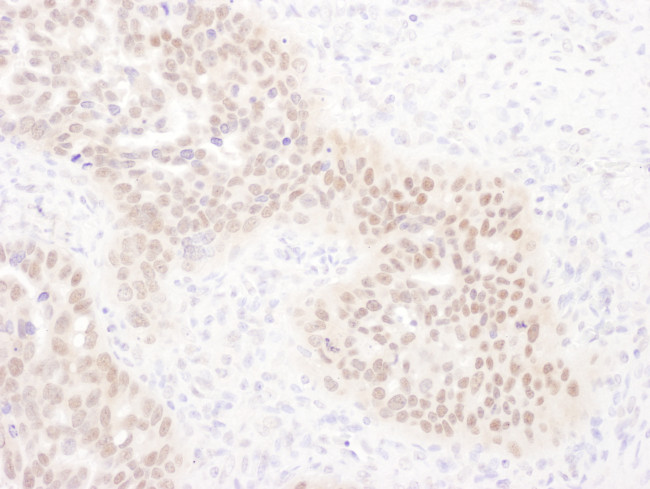 WRNIP1 Antibody in Immunohistochemistry (Paraffin) (IHC (P))