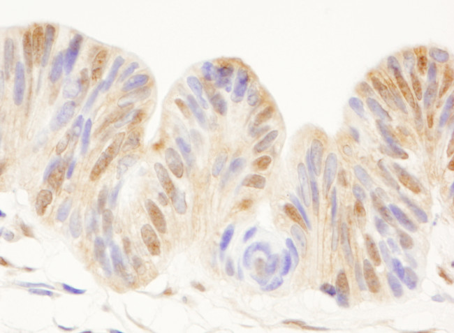 CDC25c Antibody in Immunohistochemistry (Paraffin) (IHC (P))