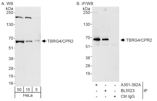 TBRG4/CPR2 Antibody in Western Blot (WB)