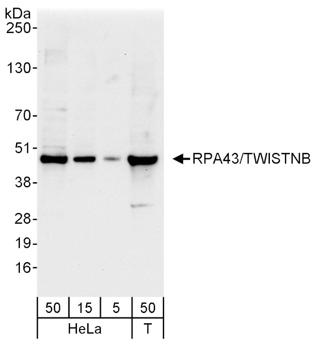 RPA43/TWISTNB Antibody in Western Blot (WB)