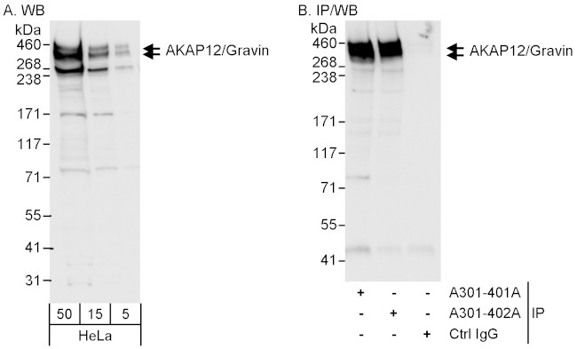 AKAP12/Gravin Antibody in Western Blot (WB)