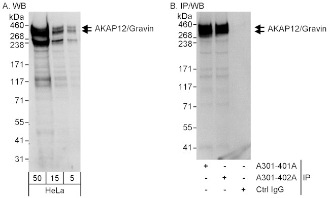 AKAP12/Gravin Antibody in Western Blot (WB)