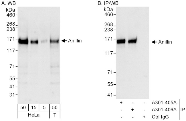Anillin Antibody in Western Blot (WB)