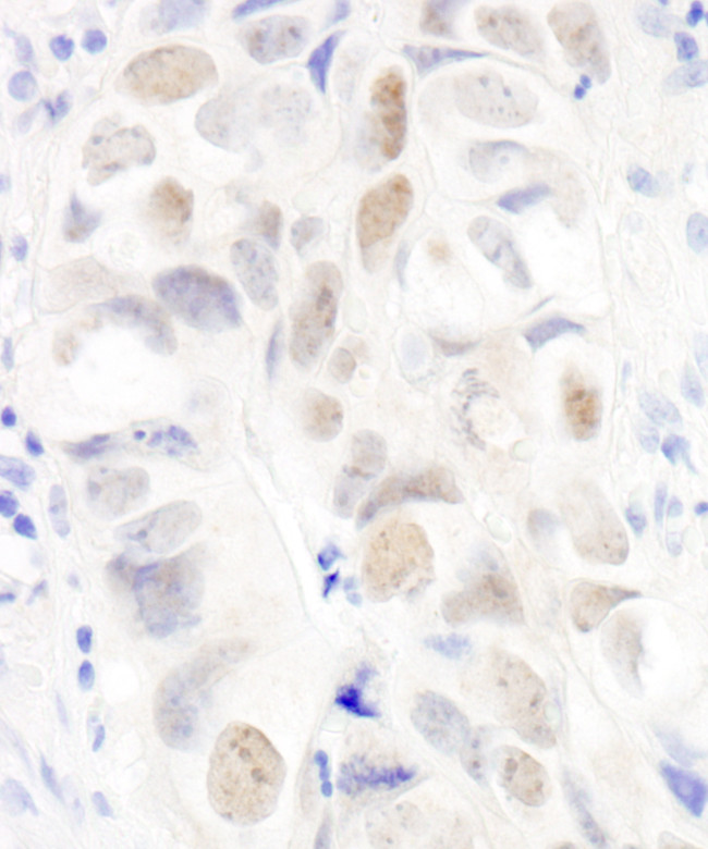 Anillin Antibody in Immunohistochemistry (Paraffin) (IHC (P))