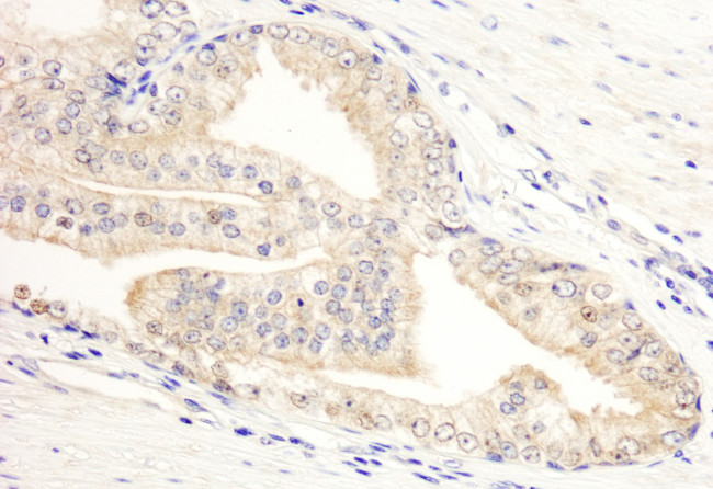 KANK2/SIP Antibody in Immunohistochemistry (Paraffin) (IHC (P))