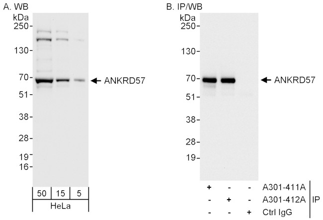 ANKRD57 Antibody in Western Blot (WB)